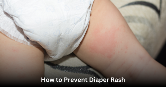 baby with the diaper to prevent rash